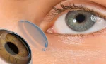 Dünyada Bir İlk 3D Yazıcıyla Üretilen Kornea Başarıyla Nakledildi