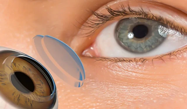 Dünyada Bir İlk 3D Yazıcıyla Üretilen Kornea Başarıyla Nakledildi