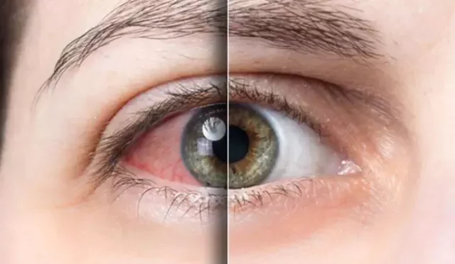 Göz Hücreleriniz Sigaraya Nasıl Tepki Veriyor Gençseniz Direniyor, Yaşlıysanız